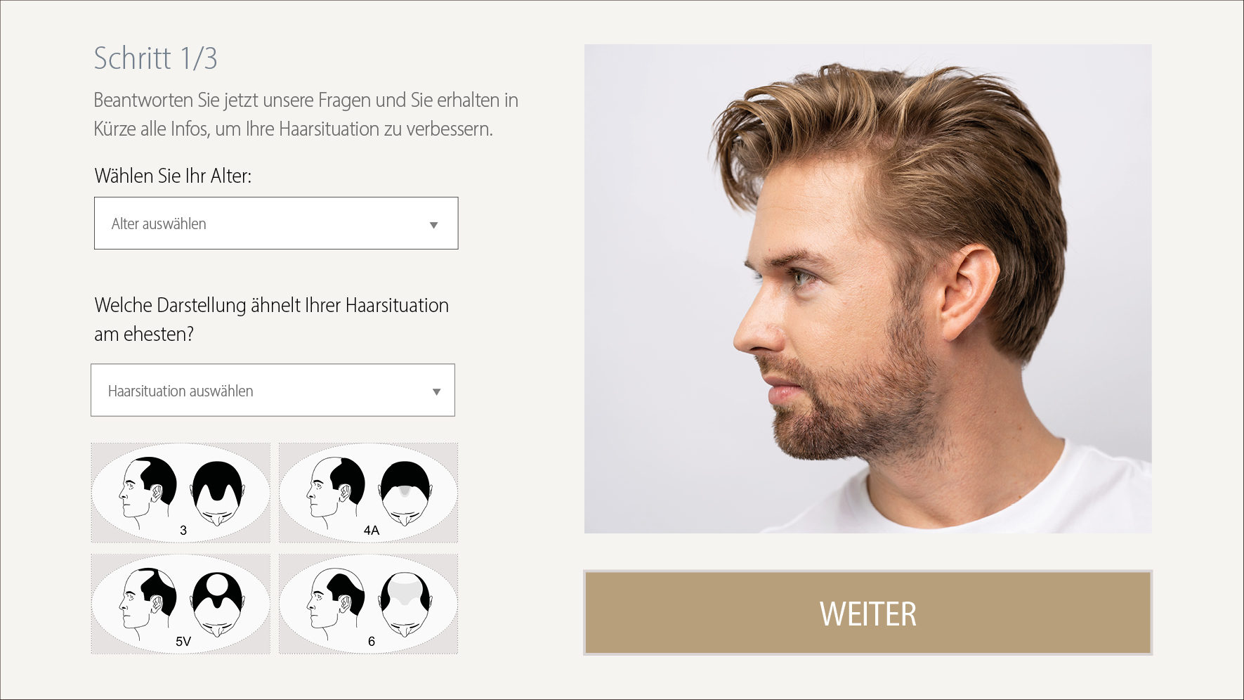 haartransplantation haarkonfigurator info medizin proaesthetic