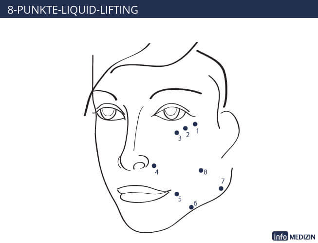 8-Punkte-Liquid-Lifting