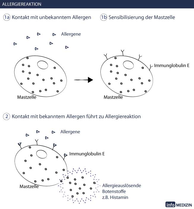 Allergiereaktion 