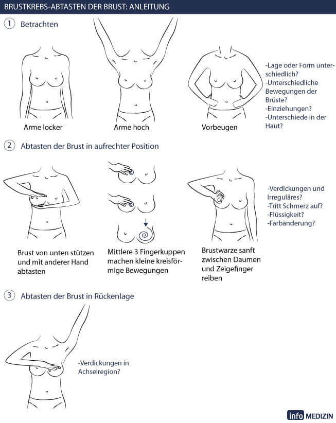 Anleitung Brust selbst abtasten