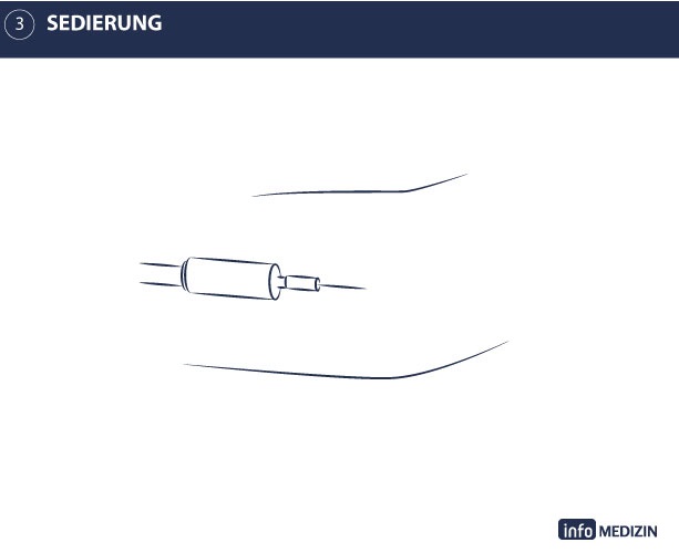 Illustration Darmspiegelung Ablauf Sedierung