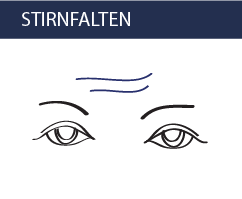 Stirnfalten