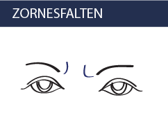 Zornesfalten